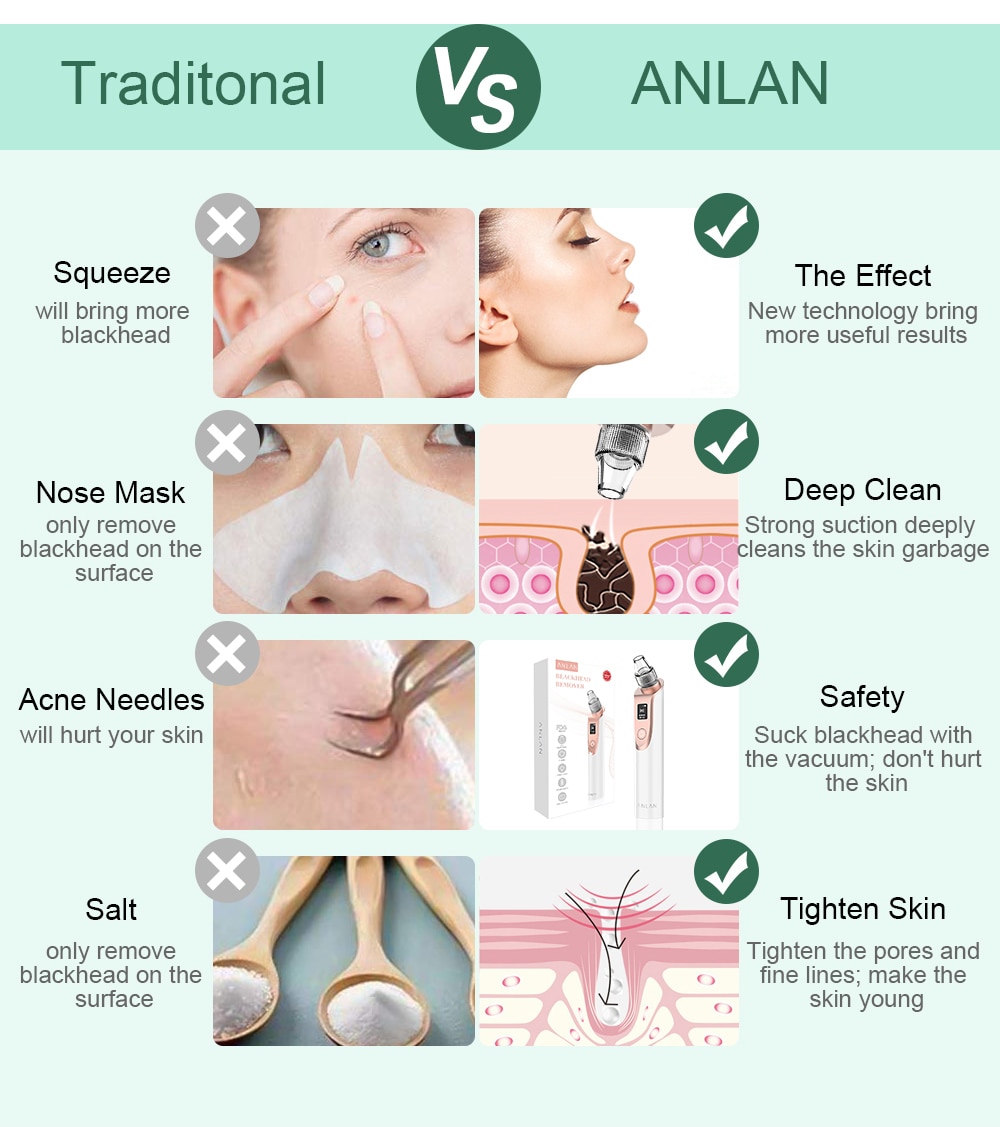 Blackhead Remover Vacuum for Pore Cleaning